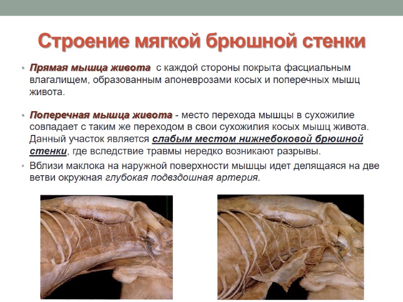 Строение мягкой брюшной стенки Прямая мышца живота  с каждой стороны покрыта фасциальным влагалищем,